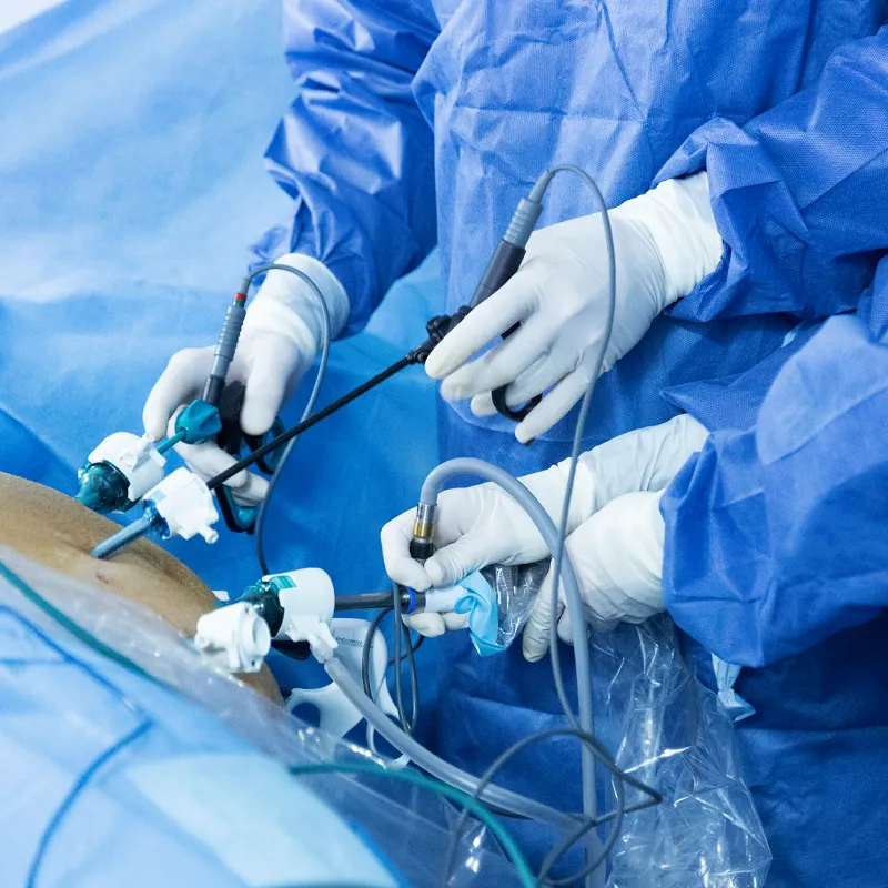 cirugia laparoscopica en gijon ¿Qué es la cirugía laparoscópica_